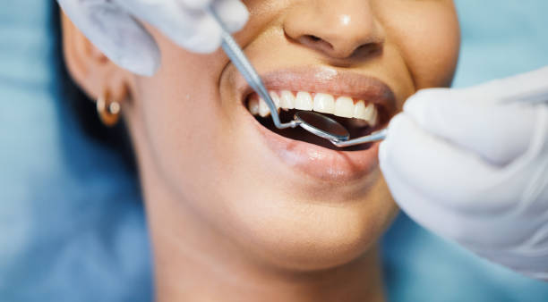 Best Teeth Whitening  in Herndon, VA